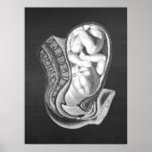 Zwangerschap baarmoeder Anatomie Obstetrisch Decor Poster (Voorkant)
