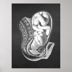 Zwangerschap baarmoeder Anatomie Obstetrisch Decor Poster