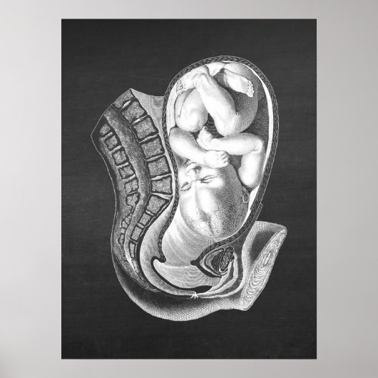 Zwangerschap baarmoeder Anatomie Obstetrisch Decor Poster (Voorkant)