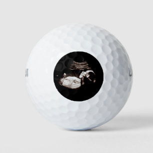 Zwangerschap Baby Echografie Ultrasound Foto Jonge Golfballen