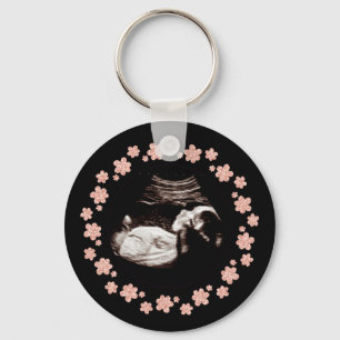 Zwangerschap Baby Glitter Sonogram Ultrageluid Fot Sleutelhanger