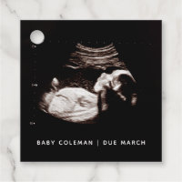 Zwangerschap Baby Sonogram Ultrageluid Foto