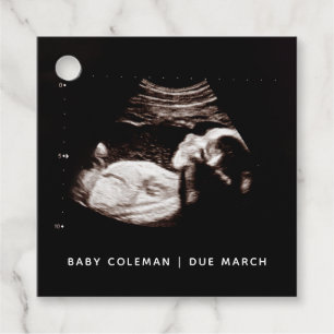 Zwangerschap Baby Sonogram Ultrageluid Foto Bedankjes Labels