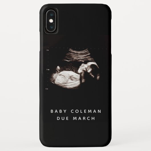 Zwangerschap Baby Sonogram Ultrageluid Foto Case-Mate iPhone Case (Achterkant)