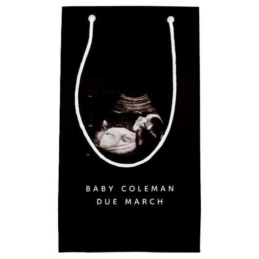 Zwangerschap Baby Sonogram Ultrageluid Foto Klein Cadeauzakje (Voorkant)