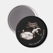 Zwangerschap Baby Sonogram Ultrageluid Foto Magneet (Voorkant / Achterkant)