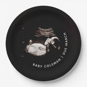 Zwangerschap Baby Sonogram Ultrageluid Foto Papieren Bordje