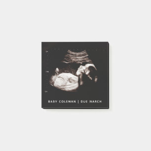 Zwangerschap Baby Sonogram Ultrageluid Foto Post-it® Notes