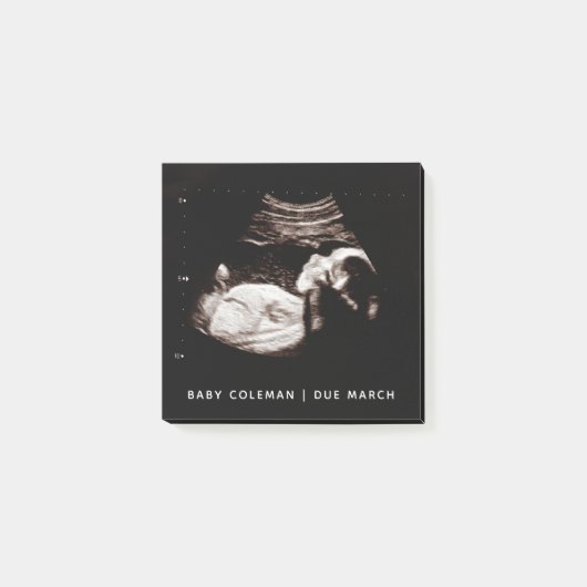Zwangerschap Baby Sonogram Ultrageluid Foto Post-it® Notes (Voorkant)