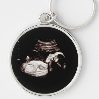 Zwangerschap Baby Sonogram Ultrasound Foto Nieuw m Sleutelhanger