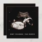 Zwangerschap Baby Sonogram Ultrasound fotokaart (Voorkant / Achterkant)