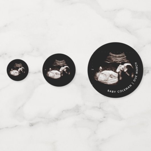 Zwangerschap Baby Sonogram Ultrasound fotokaart Confetti (Voorkanten)