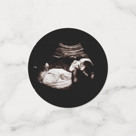 Zwangerschap Baby Sonogram Ultrasound fotokaart Confetti (Kleine voorkant)