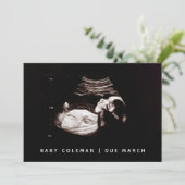 Zwangerschap Baby Sonogram Ultrasound fotokaart Kaart (Staand voorkant)