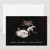 Zwangerschap Baby Sonogram Ultrasound fotokaart Kaart (Voorkant / Achterkant)