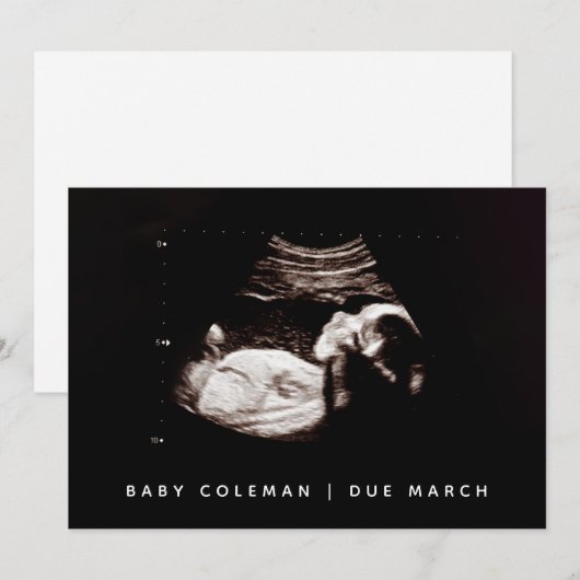 Zwangerschap Baby Sonogram Ultrasound fotokaart Kaart (Voorkant / Achterkant)