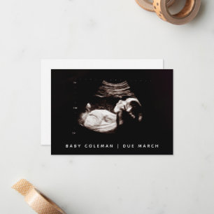 Zwangerschap Baby Ultrasound Sonogram Foto Notitiekaartje