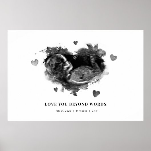 Zwangerschap echografie aankondiging binnenkort be poster (Voorkant)