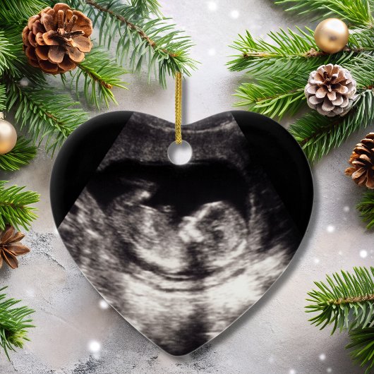 Zwangerschap Echografie Baby Foto Luchtvaart Custo Keramisch Ornament