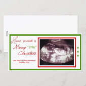 Zwangerschap Kerst Kaart- Echografie Foto Feestdagenkaart (Voorkant / Achterkant)