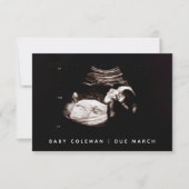 Zwangerschap Onthul Baby Echografie Sonogram Foto Notitiekaartje (Voorkant)