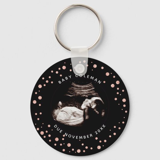 Zwangerschap Roze Glitter Sonogram Ultrageluid Fot Sleutelhanger (Voorkant)
