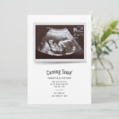Zwangerschap ScanSonogram Baby Aankondiging (Staand voorkant)