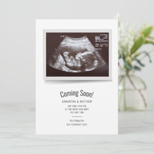 Zwangerschap ScanSonogram Baby Aankondiging (Staand voorkant)
