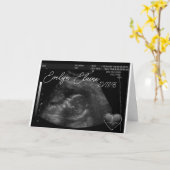 Zwangerschap Sonogram baby schattig aanpasbaar Kaart (Gele Bloem)