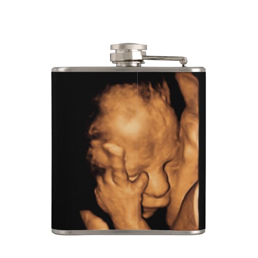 Zwangerschap Ultrageluid Sonogram Baby Foto Heupfles (Achterkant)
