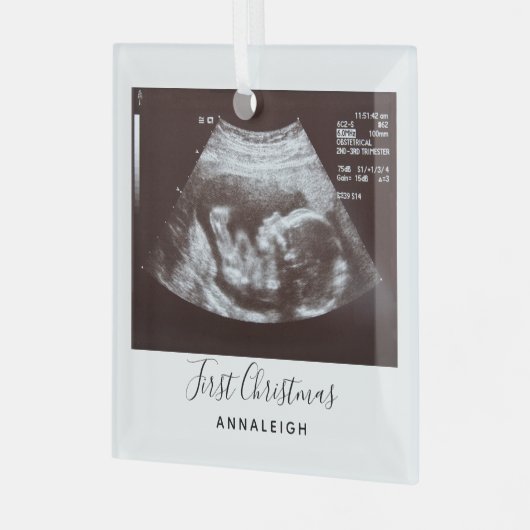 Zwangerschap Ultrasound Foto Eerste Kerstfeestdag Glas Ornament (Voorkant links)