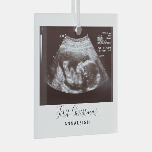 Zwangerschap Ultrasound Foto Eerste Kerstfeestdag Glas Ornament (Voorkant Rechts)