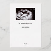 Zwangerschapsaankondiging Classy Gold folie overla Feestdagenkaart (Achterkant)