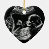 Zwangerschapsaankondiging Ultra Sound Kerstmis Keramisch Ornament (Achterkant)