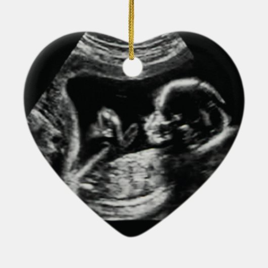 Zwangerschapsaankondiging Ultra Sound Kerstmis Keramisch Ornament (Achterkant)