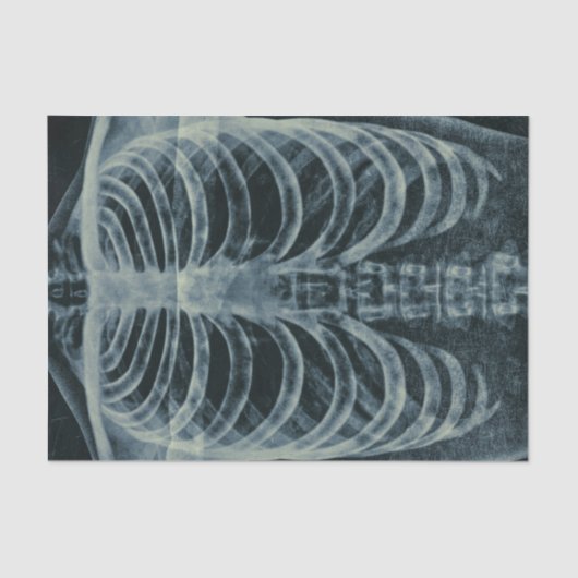 zwart-wit skelet-beeldscherm tissuepapier (Voorkant)