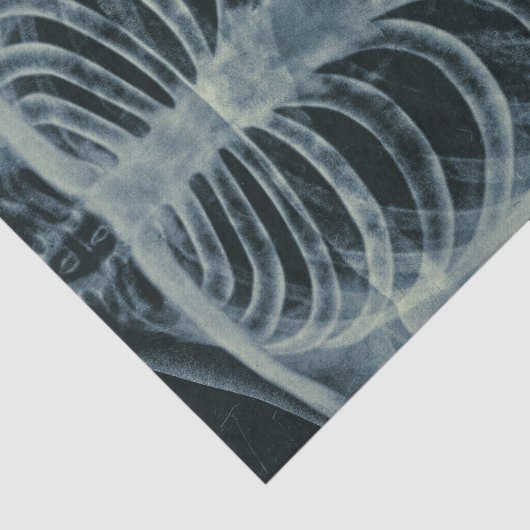 zwart-wit skelet-beeldscherm tissuepapier (Detail)